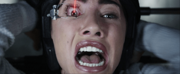 Olivia's_eye_gets_burnt